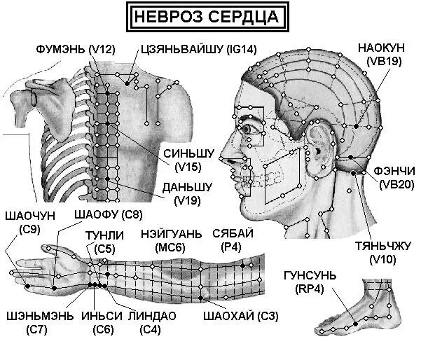 Иглоукалывание при неврозе. Фэн-мэнь v 12. акупунктурные точки при неврозе. акупунктура при неврозе. точки акупунктуры при заболеваниях.
