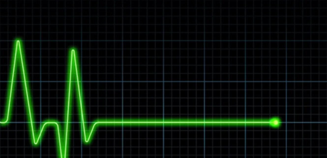 Сердцебиение кардиограмма. Причины сниженной частоты пульса. Пульс. Пульс презентация. Линия пульса.