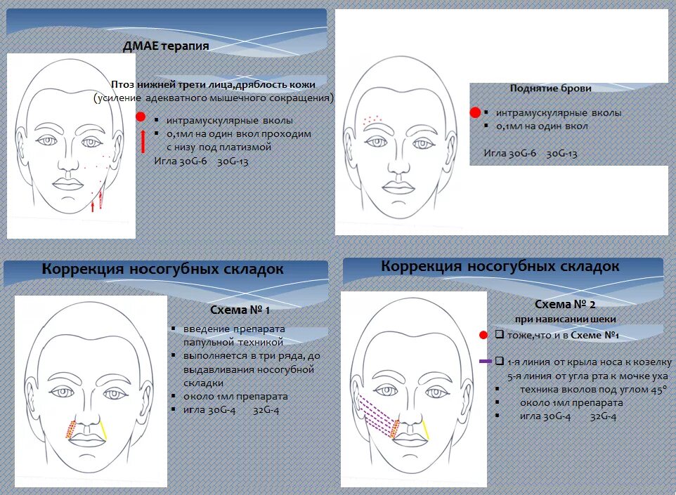 Схемы инъекций ДМАЕ. ДМАЕ схема введения лицо. Схема уколов ДМАЕ. Схема мезотерапии лица с ДМАЕ.