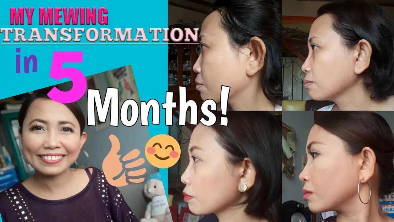 Мьюинг упражнения для лица. Mewing Transformation. Mewing before and after. How to do mewing. Mewing before and after woman.