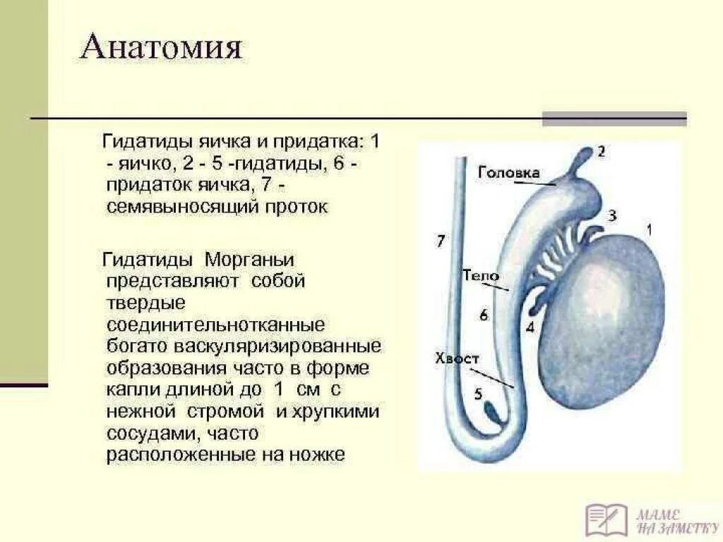 Тянущая боль у мужчины правого яичка. Кальцинированная гидатида. Острое поражение гидатиды яичка. Клинические признаки перекрута гидатиды яичка. Перекрут гидатиды яичка у мальчика.