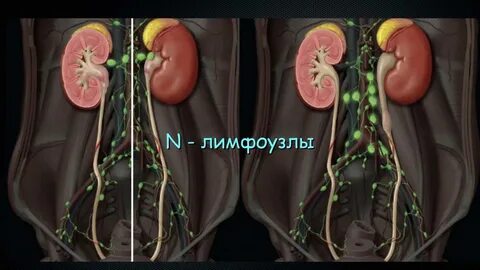 Кт урология