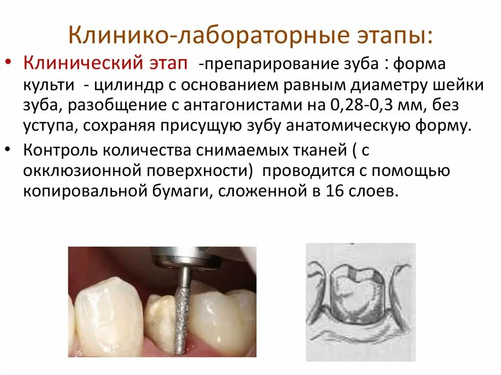 Клинические рекомендации протезирование
