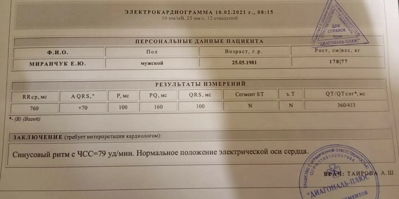 Смещение st вверх v4 v5. Смещение st вверх в v3v4. смещение st вверх на экг. смещение st вверх v3 v4 v5 v6.