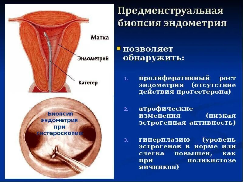 Что такое эндометрия матки. Что такое эндометрия матки