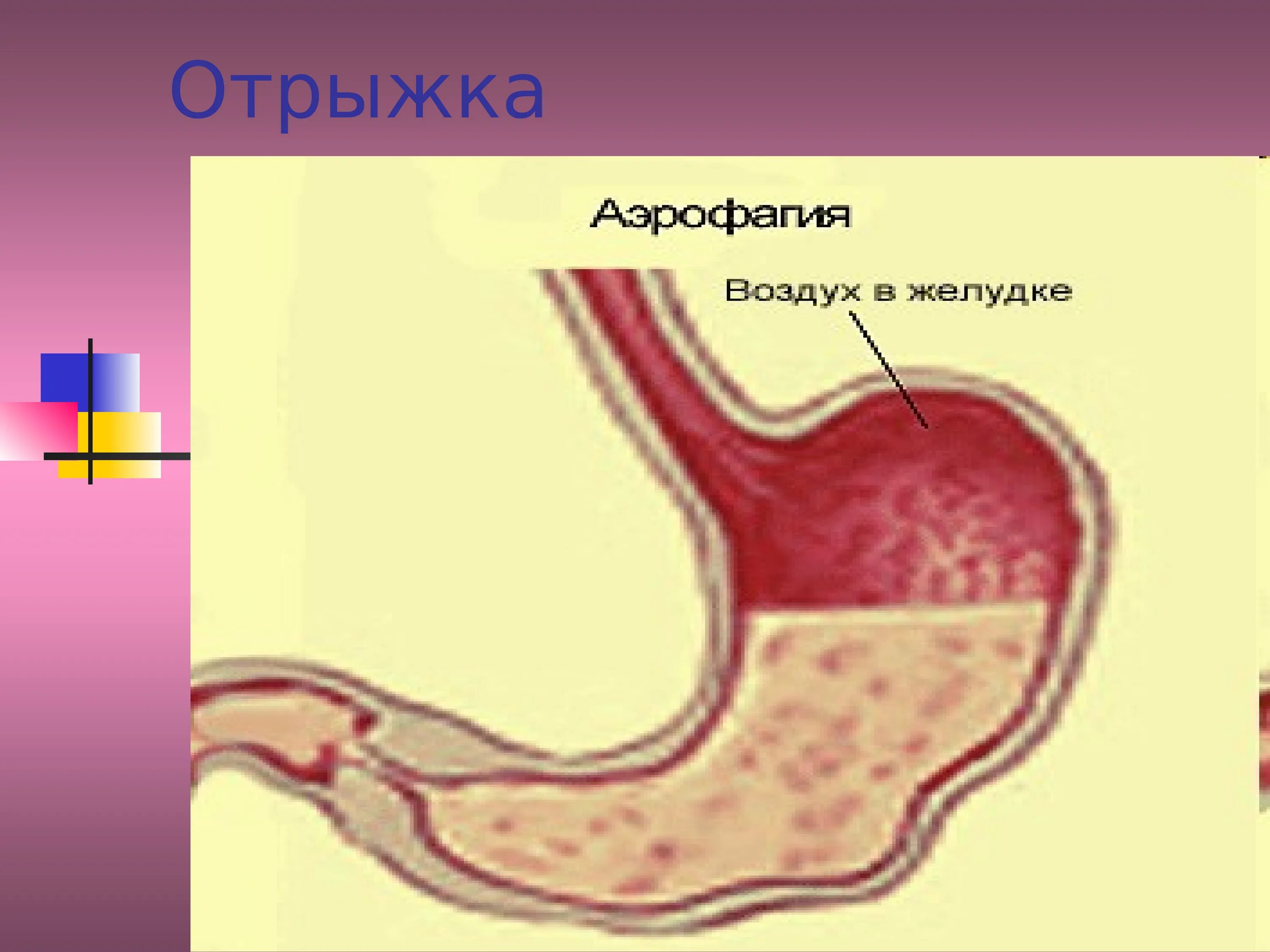 Отрыжка. Воздух в желудке причины. Отрыжка воздухом. Желудок воздух отрыжка. Воздух в области желудка