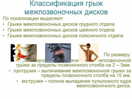 Какой размер грыжи считается большим