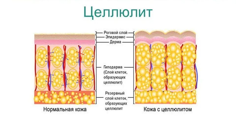 Клетчатка строение и функции. Адипоциты гиподермы. Гиподерма это подкожная жировая клетчатка. Жировая ткань гиподерма. Гиподерма соединительная ткань.