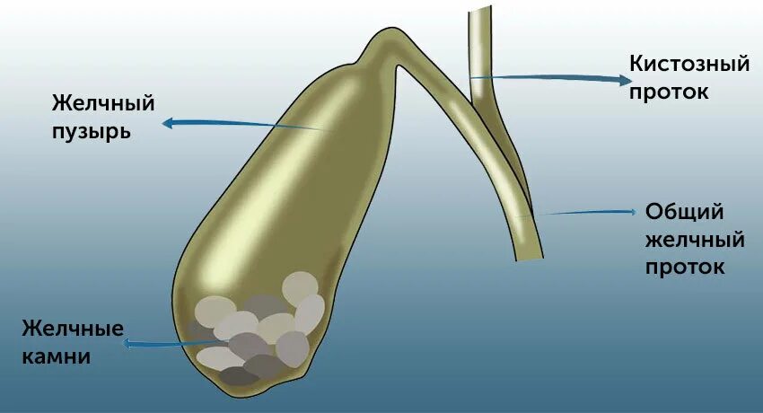 Желчный пузырь глаза