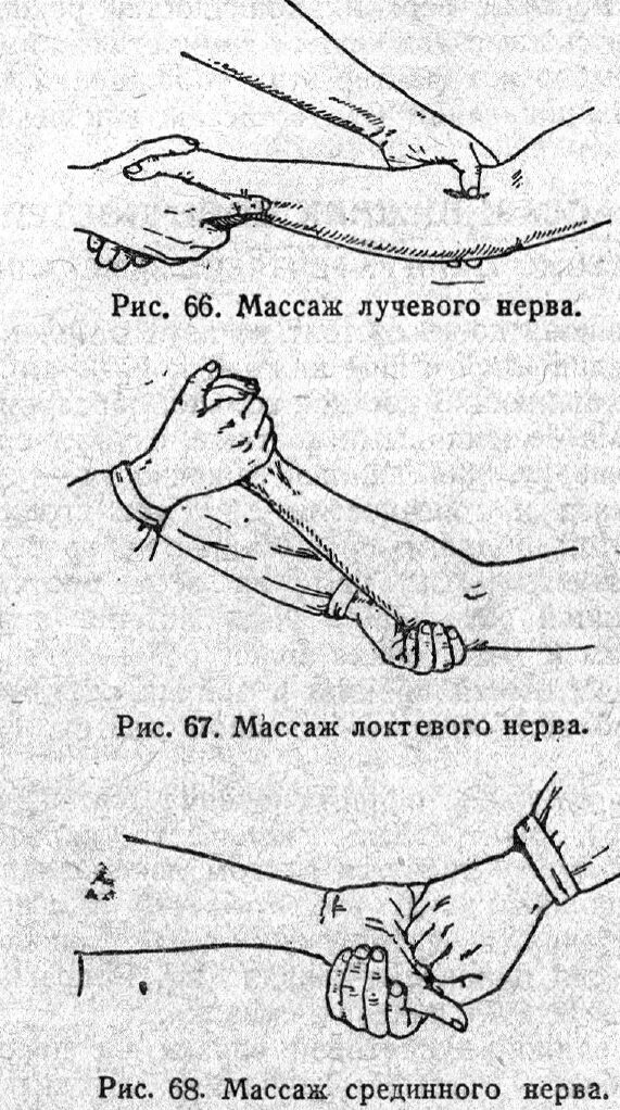 Восстановление нервов после операции. Контрактура локтевого сустава комплекс ЛФК. Невропатия локтевого нерва лечебная физкультура. Нейропатия лучевого и срединного нерва. Точечный массаж при неврите локтевого нерва.