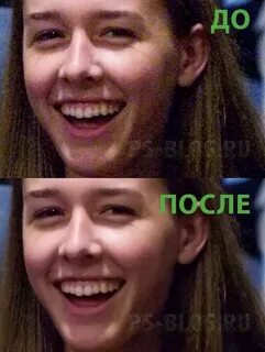 Шум на фото