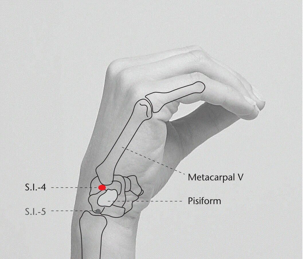 Найти точку дж. Ig 5 точка акупунктуры. Ig 4 точка акупунктуры. Точка ig4 Вань ГУ. Si4точка акупунктуры.