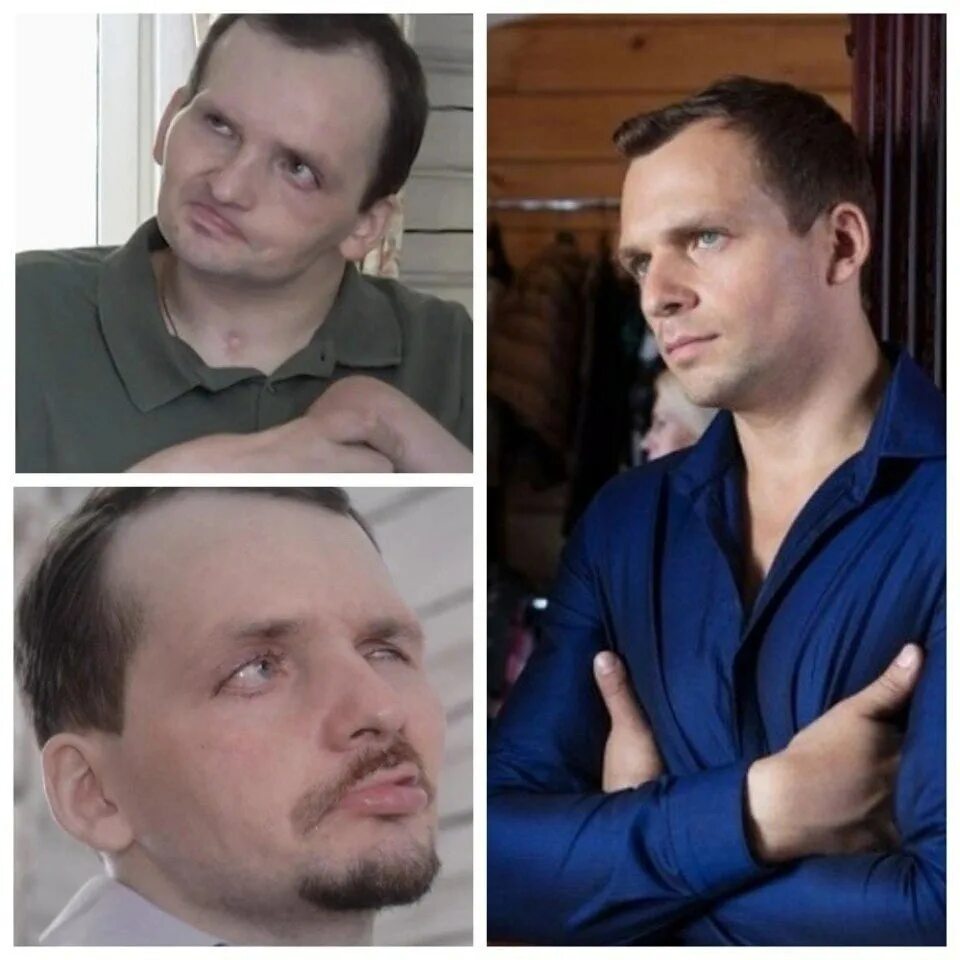 Раскрывая душу сквозь боль и триумф: Алексей Янин - актер, переживший инсульт Ст