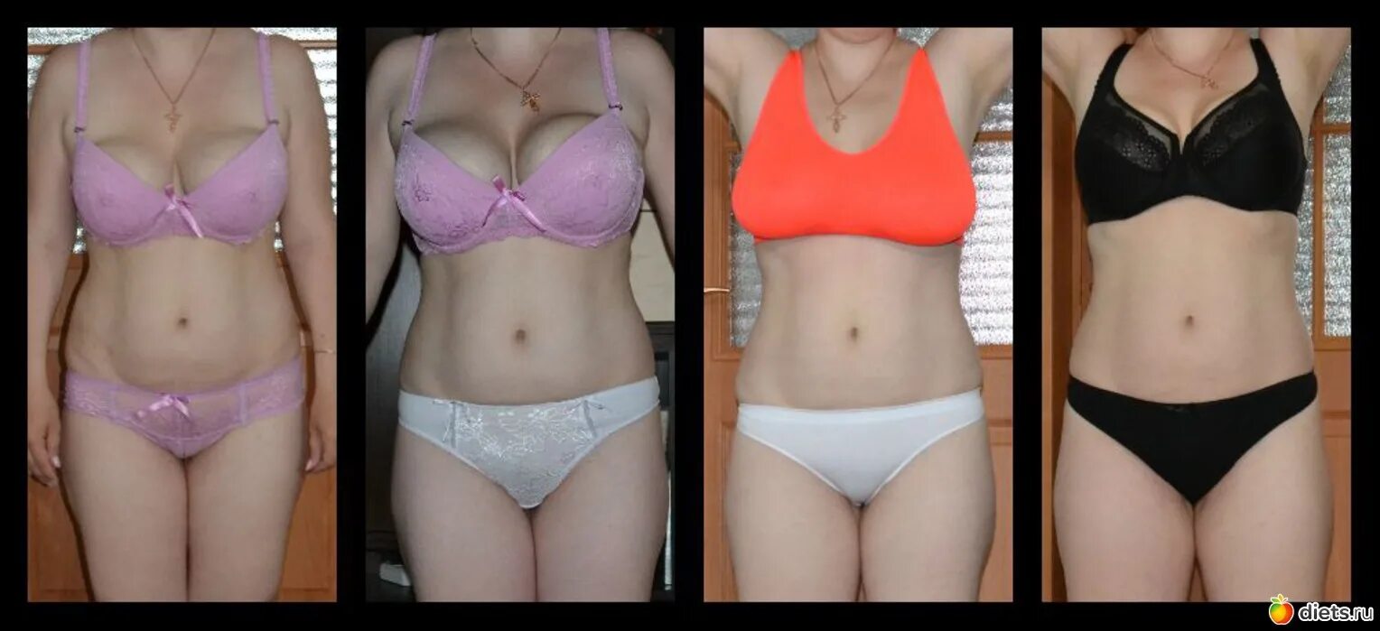 Грудь до и после отзывы Celebrity plastic surgery, Implants breast, Worst celebrities