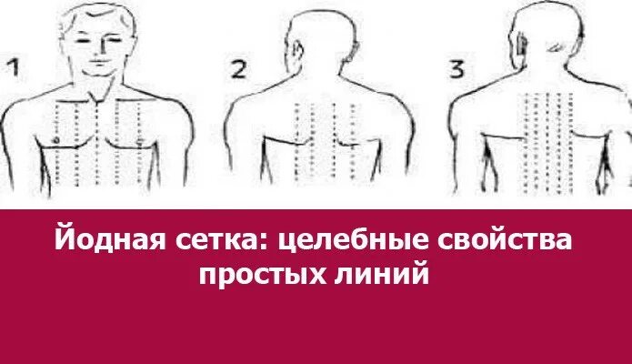 Можно ли делать йодовую сетку при температуре