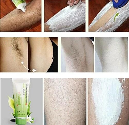 Удаление в интимных местах. Удаление в интимных местах
