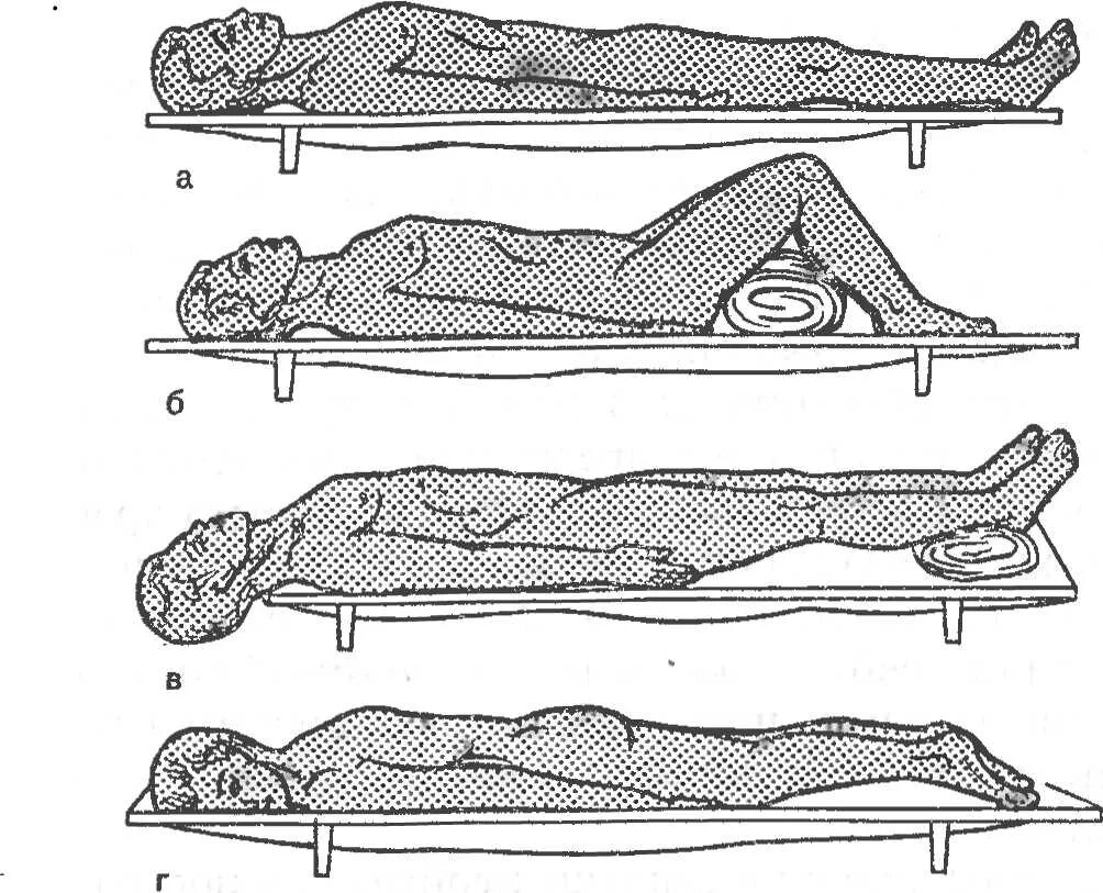 При травмах брюшной полости пострадавшего транспортируют. Способ транспортировки пострадавшего при большой кровопотере. Позы для транспортировки пострадавших. Транспортировка пострадавших с различными травмами. Положение пострадавшего при повреждении позвоночника