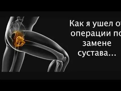 Когда меняют сустав