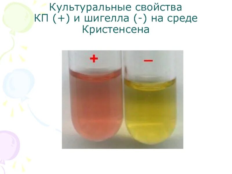 Шигеллы зонне на средах. Шигеллы на среде олькеницкого. Сальмонелла на плоскирева. Шигеллы питательные среды. Шигеллы питательные среды.