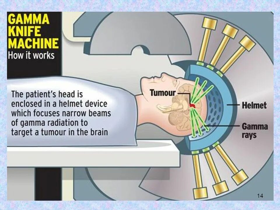 Гамма нож. Gamma Knife device. Гамма нож схема.