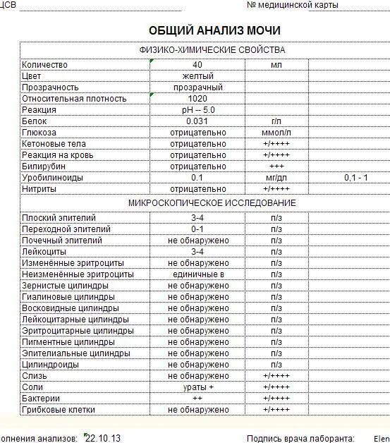 Показатели Глюкозы в моче норма. Нормы показателей Глюкозы в крови, моче. Нормы Глюкозы в моче у взрослых. Анализ мочи расшифровка у женщин норма Глюкоза. Белок 0 13