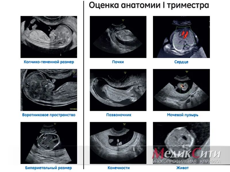 Сердцебиение плода девочка. Пол ребёнка по сердцебиению. Как определить пол по сердцебиению. Определение пола по сердцебиению плода. Сердцебиение ребенка пол ребенка.