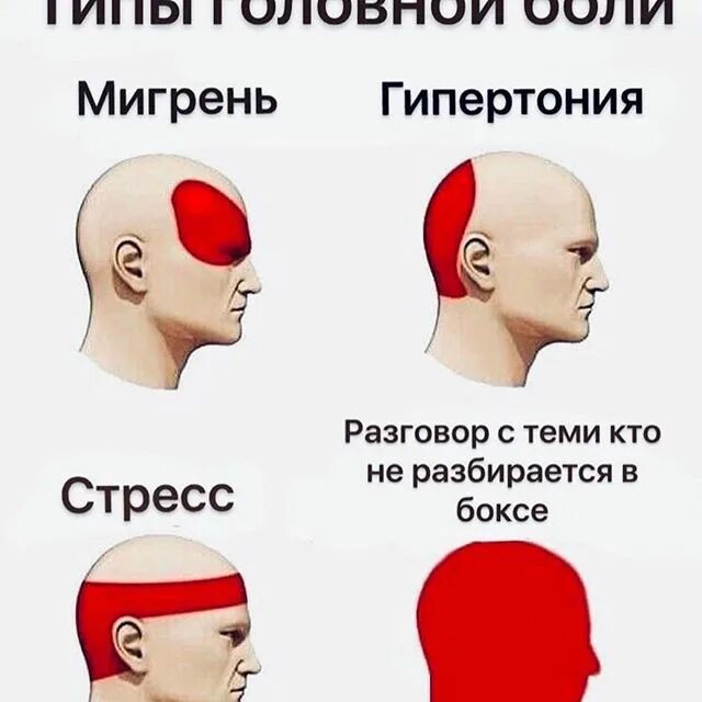 причины головной. боль в висках головы. головная боль в висках. головная боль мигрень. кластерная головная боль.