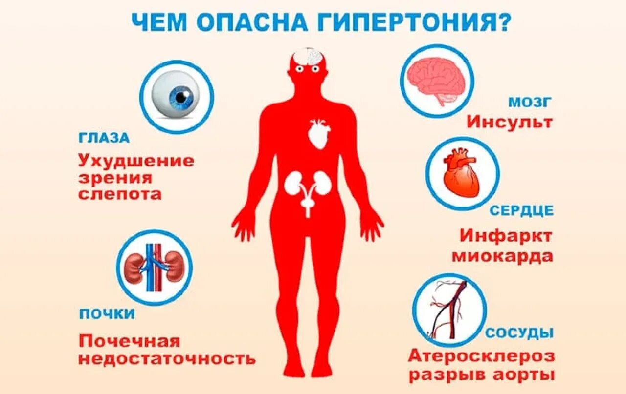 Гипертензия что. Гипертоническая болезнь. Факторы риска гипертонии. Факторы риска при гипертонической болезни. Чем опасна гипертония.