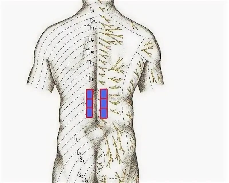 Паравертебральные точки поясничного отдела позвоночника. Паравертебральные точки грудного отдела позвоночника. Паравертебральные болевые точки. Паравертебральная область спины.