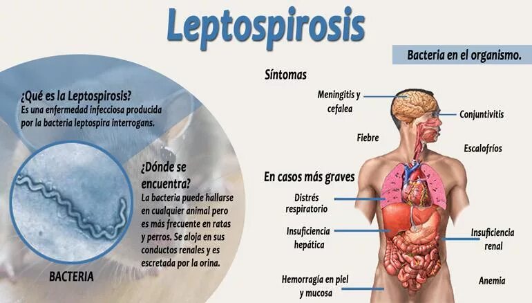 Лептоспироз бактерия. Патогенез лептоспироза у человека. Leptospirosis pathogenesis. Лептоспироз гепатит