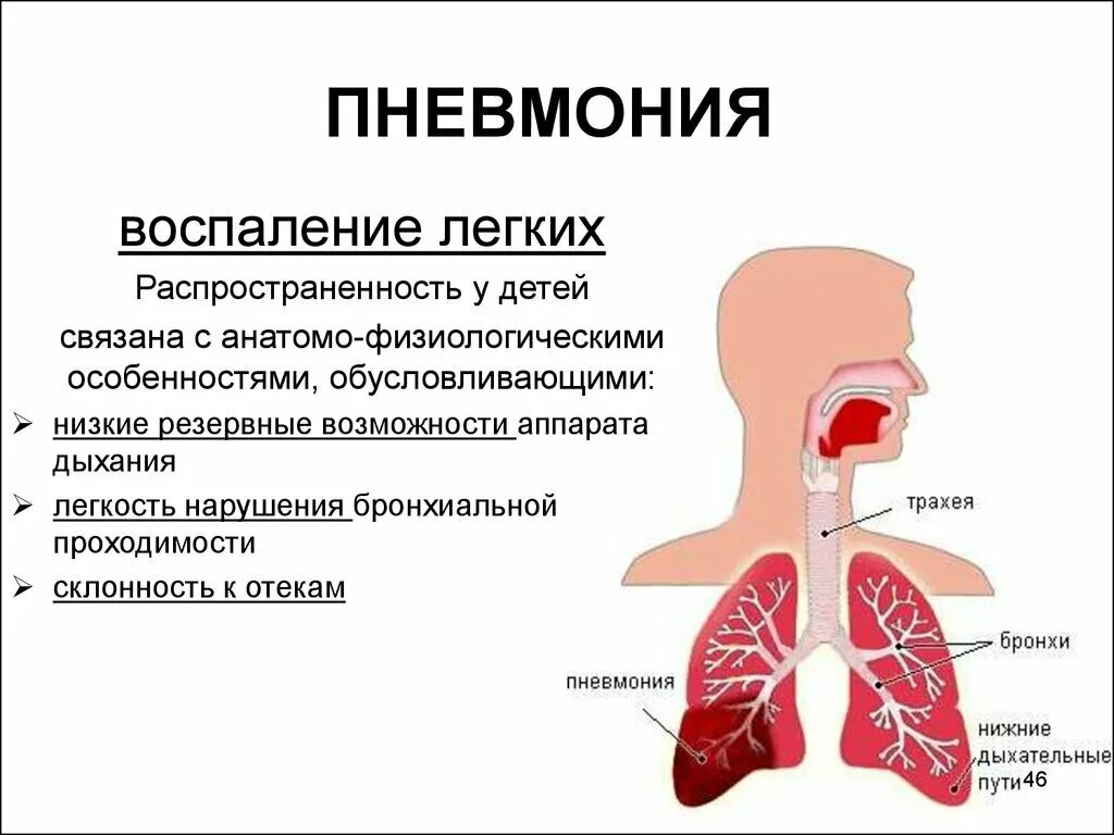 Легочные проявления пневмонии.