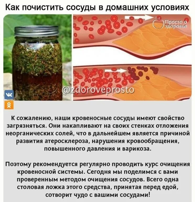 Как прочистить сосуды. Как очистить сосуды. чистка артерий и сосудов. чистка сосудов народными средствами. как чистить сосуды домашний условия.