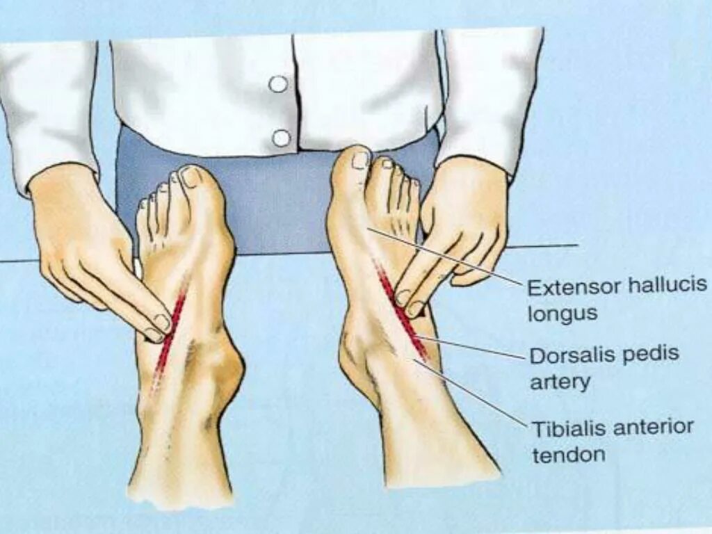 Артерия дорсалис педис пальпация. Пульсация артерий нижних конечностей пальпация. Пальпация пульса на артериях стопы. Пульсация артерий стопы