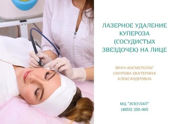 Розацеа фотокоагуляция. Сосудистые звездочки розацеа. Купероз сосудистые звездочки. Купероз сосудистые звездочки. Розацеа телеангиэктазии.