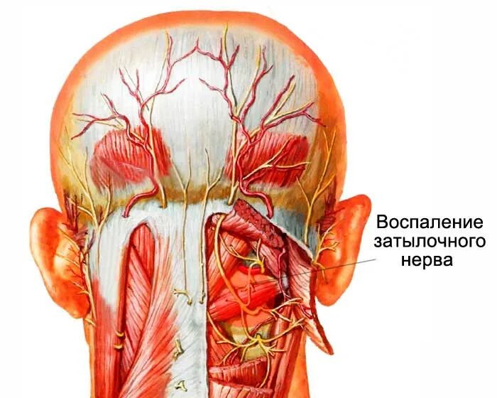 Почему воспаляется нерв. Невралгия затылочного нерва симптомы. Большой затылочный нерв анатомия. Подзатылочный нерв анатомия. Невралгия затылочного нерва нерва.