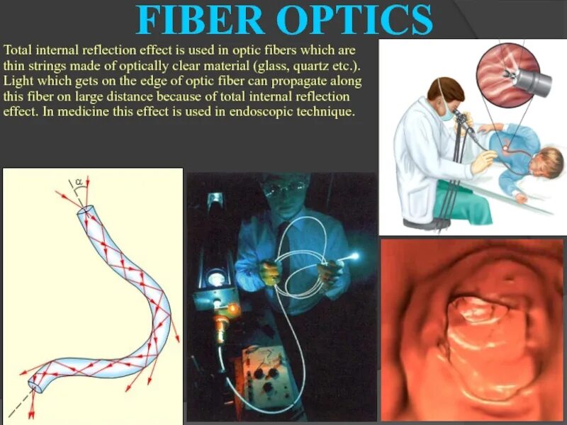 Волоконная оптика в медицине. Полное внутреннее отражение в медицине. Световоды волоконная оптика. Использование волоконной оптики в медицине.