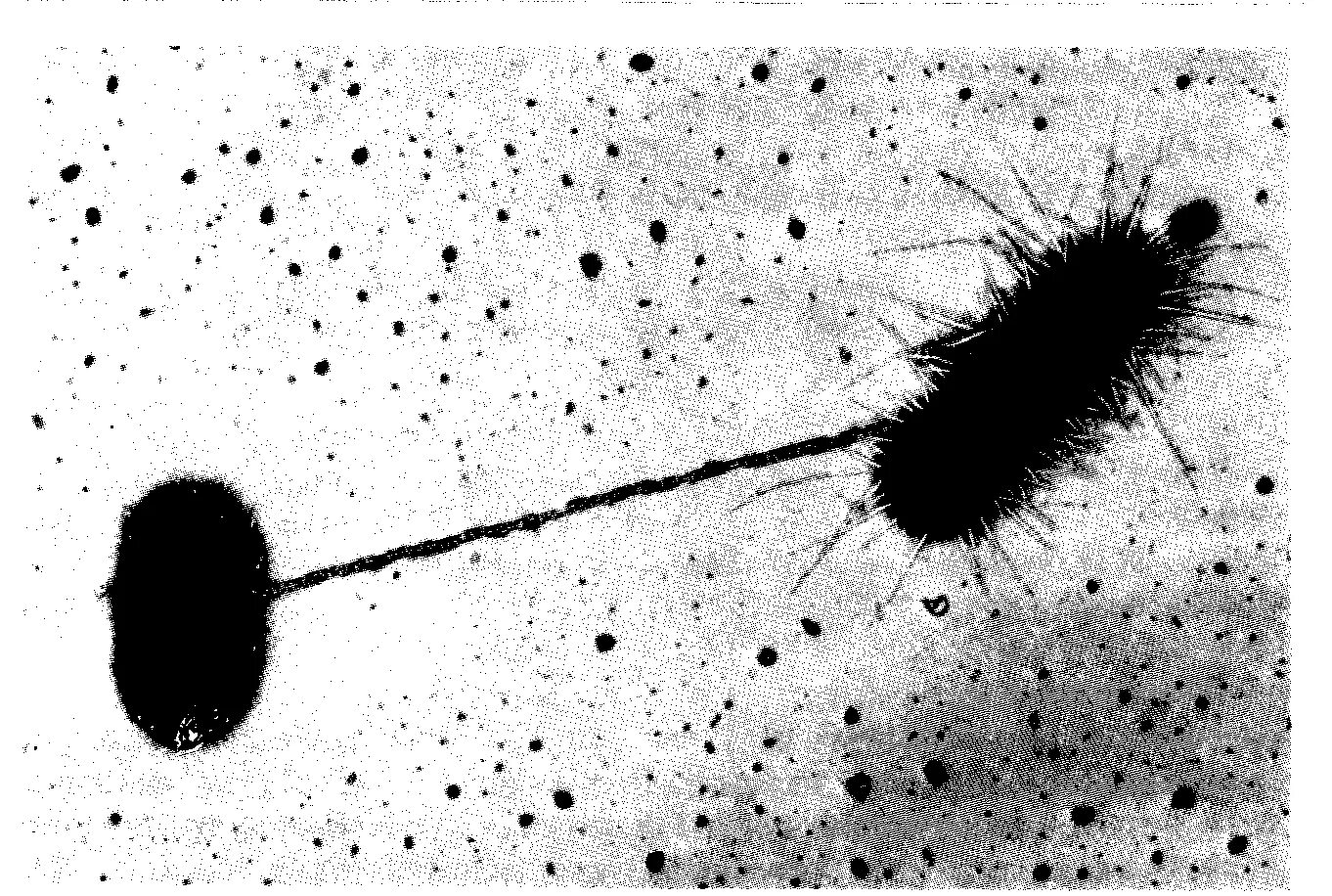 Микрофотография бактериальной клетки. Прокариотическая клетка пили. Микрофотография бактериальной клетки. Строение пилей бактерий. Прокариотическая клетка в микроскопе.