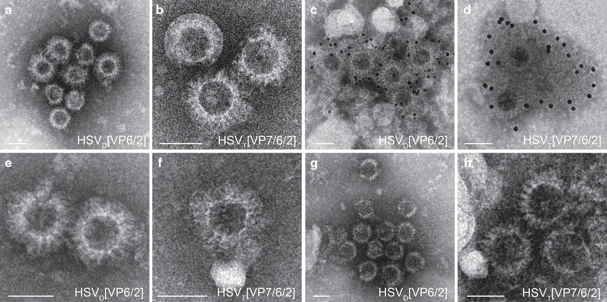Herpes simplex 1 и 2