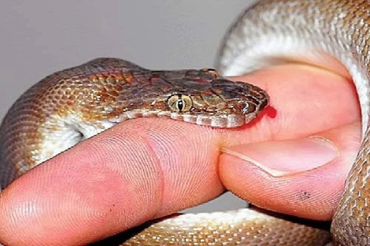 Snake bites