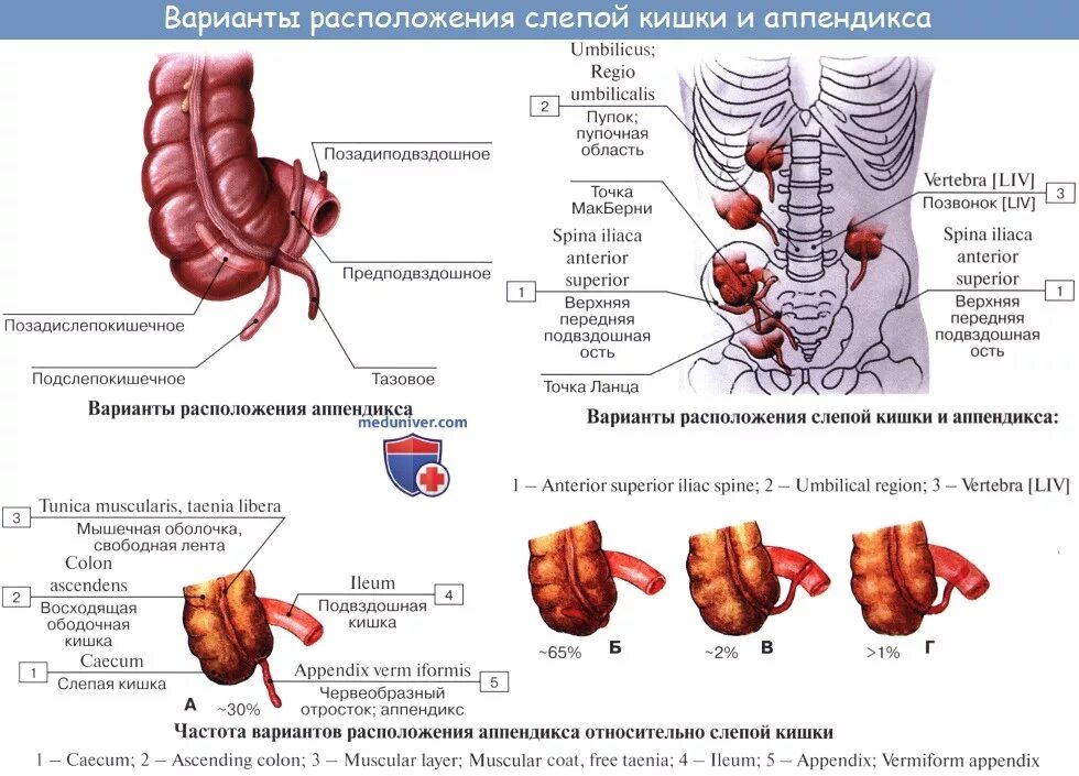 Строение слепой кишки и аппендикса. Строение червеобразного отростка. Расположение аппендикса топографическая анатомия. Слепая кишка с аппендиксом строение. Слепая кишка расположена