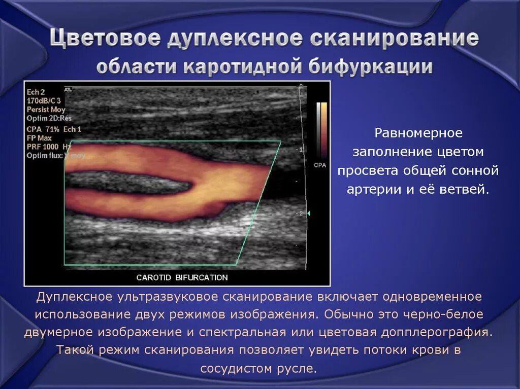 Что такое уздг. Дуплексное сканирование. Доплексноесканирование. Дуплексное исследование сосудов.  Дуплексное и триплексное сканирование сосудов.