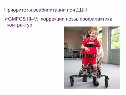 Уровни дцп