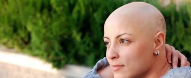 Фото после химиотерапии. Люди после химиотерапии. Женщины после химиотерапии фото. Волосы после химиотерапии.