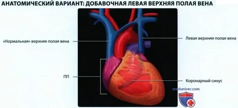 Поперечный срез четырехкамерного сердца
