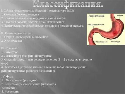 Язва симптомы у взрослых мужчин