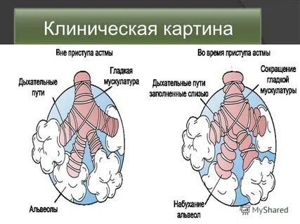 Хобл мужчина