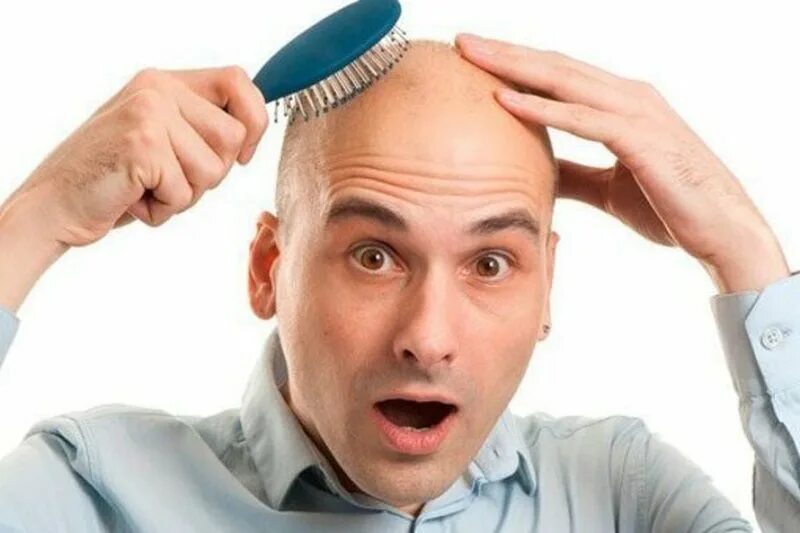 про голова мужчину. здоровые мужские волосы. лысеющий мужчина. резиновая маска на голову. головная боль.