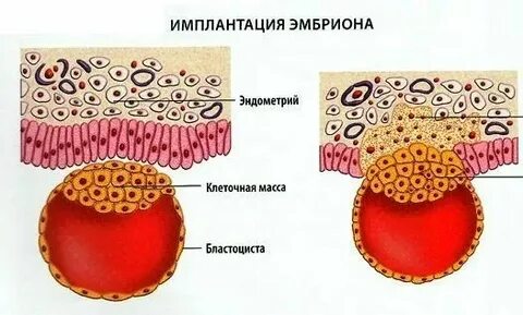 Симптомы имплантации форум