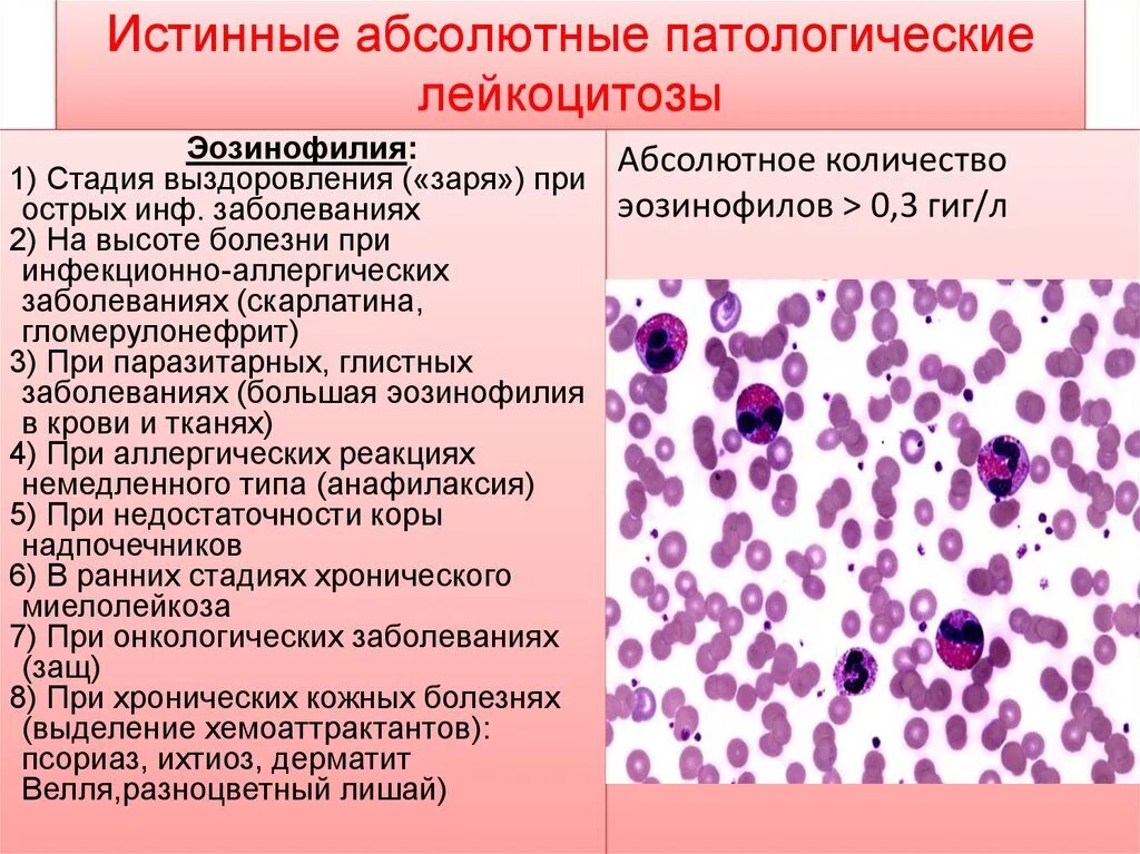 Эозинофильный лейкоцитоз картина крови. Хронический миелолейкоз показатели лейкоцитов. Лейкоциты периферической крови. Анемия, лейкопения, повышение СОЭ. 5 лейкоцитоз