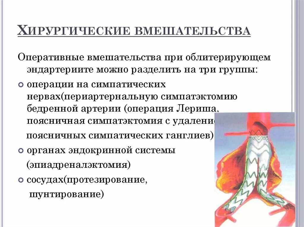 Атеросклеротические атеросклеротические поражения конечностей. Операции при облитерирующем эндартериите. Операции при облитерирующем атеросклерозе. Атеросклеротическое поражение нижних конечностей. Хирургические заболевания сосудов нижних конечностей.